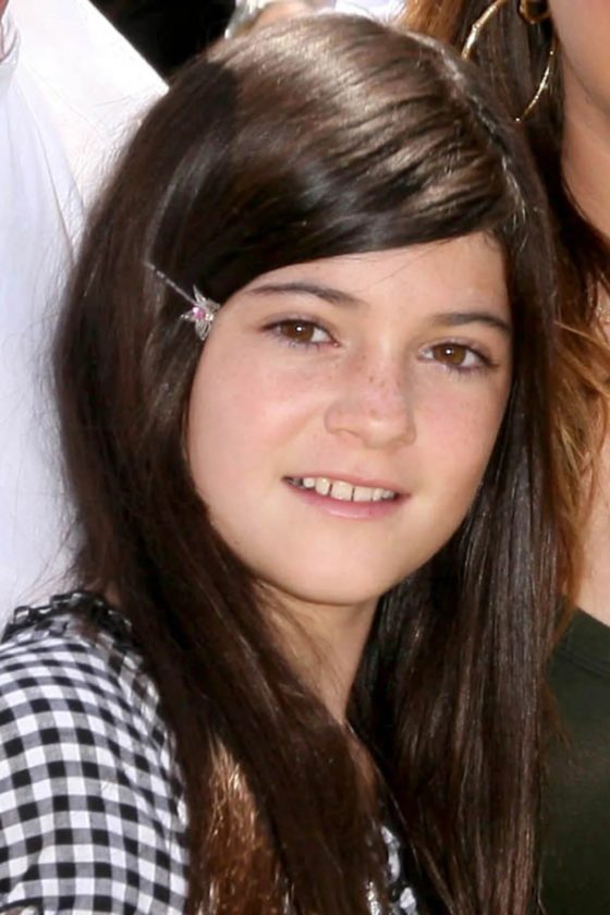 Kylie Jenner Before Plastic Surgery And After Pictures p18